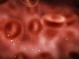Сепсис крови лечение народными средствами thumbnail